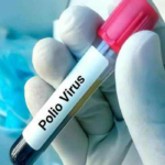 Islamabad reports first polio case in 16 years, total national cases rise to 17